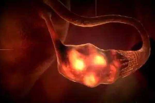 因染色体异常流产_老公弱精怀孕了_破卵针在泰国试管婴儿助孕过程中扮演着怎