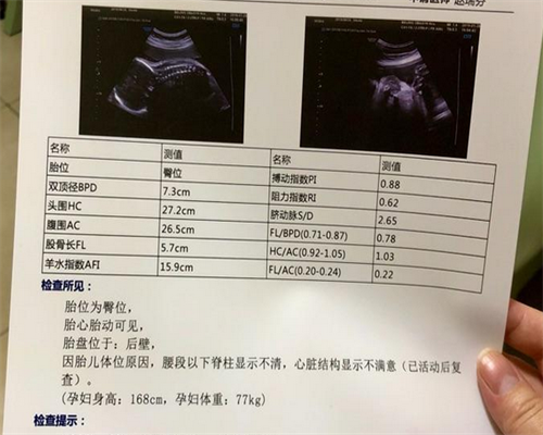 35岁以上试管
